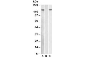 Western blot of HEK293 lysate overexpressing human NLRP2 with DYKDDDDK tag probed with NALP2 antibody [1ug/ml] in Lane A and probed with anti-DYKDDDDK tag [1/1000] in lane C. (NLRP2 antibody)