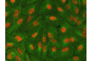 IF analysis of SAP130 using anti-SAP130 antibody (ABIN7601247) and anti-Tubulin Alpha antibody (ABIN7600339). (SAP130 antibody  (AA 309-913))