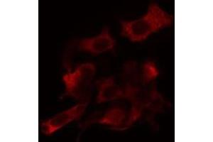 ABIN6266813 staining Hela cells by IF/ICC. (AGPAT9 antibody  (Internal Region))
