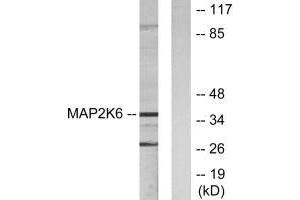 Western blot analysis of extracts from 293 cells, using MAP2K6 antibody. (MAP2K6 antibody  (N-Term))