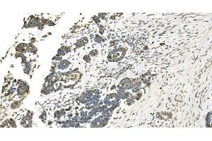 IHC analysis of IDH2 using anti-IDH2 antibody (ABIN7602787). (IDH2 antibody  (C-Term))