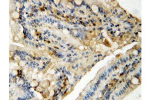 Anti-MAPK8/9 antibody, IHC(P) IHC(P): Rat Intestine Tissue (JNK antibody  (Middle Region))