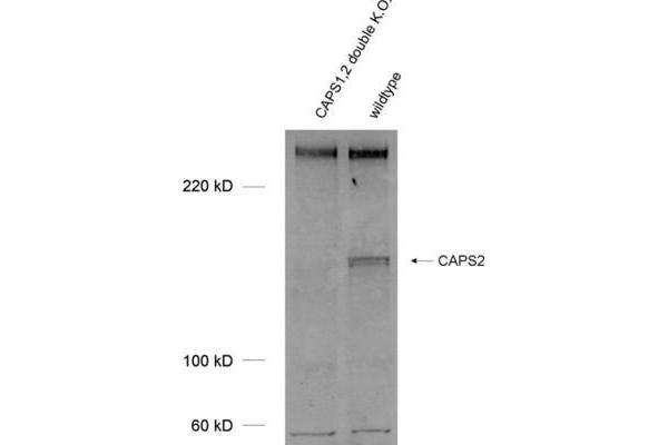 Calcyphosine 2 抗体  (AA 15-89)