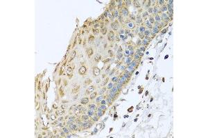 Immunohistochemistry of paraffin-embedded human esophagus using ARFGAP3 antibody at dilution of 1:100 (x40 lens). (ARFGAP3 antibody)