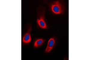 Immunofluorescent analysis of ADPGK staining in HeLa cells. (ADPGK antibody  (Center))