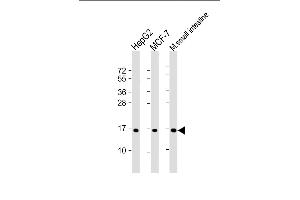 All lanes : Anti-COXIV Isoform 2 Antibody at 1:2000 dilution Lane 1: HepG2 whole cell lysate Lane 2: MCF-7 whole cell lysate Lane 3: mouse small intestine lysate Lysates/proteins at 20 μg per lane. (COX IV antibody  (Isoform 2))