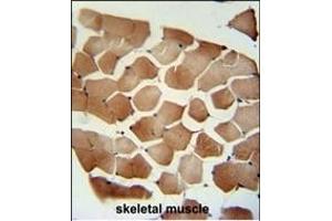 FLCN Antibody (C-term) (ABIN652601 and ABIN2842403) immunohistochemistry analysis in formalin fixed and paraffin embedded human skeletal muscle followed by peroxidase conjugation of the secondary antibody and DAB staining.