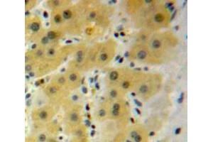Used in DAB staining on fromalin fixed paraffin-embedded Liver tissue (HSPB2 antibody  (AA 12-170))