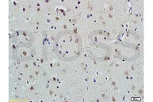 Formalin-fixed and paraffin embedded rat brain labeled with Anti-PLAUR Polyclonal Antibody, Unconjugated (ABIN675443) at 1:200 followed by conjugation to the secondary antibody and DAB staining (PLAUR antibody  (AA 201-300))
