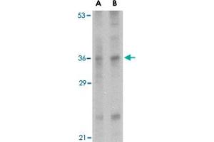 Western blot analysis of IL33 in human lymph node tissue lysate with IL33 polyclonal antibody  at (A) 1 and (B) 2 ug/mL . (IL-33 antibody  (Internal Region))
