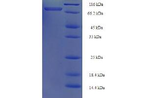 SDS-PAGE (SDS) image for TNF Receptor-Associated Factor 5 (TRAF5) (AA 1-557), (full length) protein (His-SUMO Tag) (ABIN5710548)