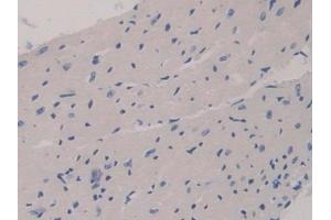 Detection of GAB3 in Mouse Heart Tissue using Polyclonal Antibody to GRB2 Associated Binding Protein 3 (GAB3) (GAB3 antibody  (AA 142-375))