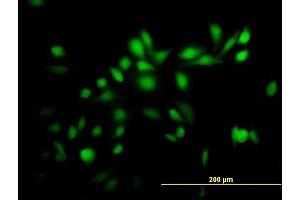 Immunofluorescence of purified MaxPab antibody to TRIM39 on HeLa cell. (TRIM39 antibody  (AA 1-488))