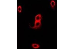 Immunofluorescent analysis of p67 phox staining in Hela cells. (NCF2 antibody)