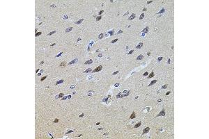 Immunohistochemistry of paraffin-embedded rat brain using PLK4 antibody. (PLK4 antibody)