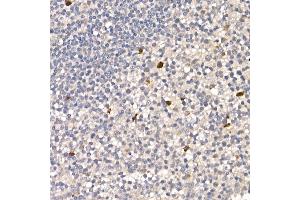 Immunohistochemistry of paraffin-embedded human tonsil using NUR77 Rabbit pAb (ABIN6132395, ABIN6144826, ABIN6144829 and ABIN6222380) at dilution of 1:100 (40x lens). (NR4A1 antibody  (AA 1-170))