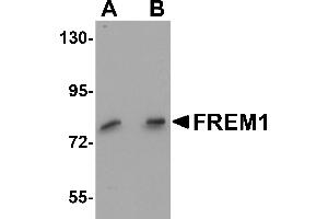 Western Blotting (WB) image for anti-FRAS1 Related Extracellular Matrix 1 (FREM1) (C-Term) antibody (ABIN1030402) (FREM1 antibody  (C-Term))