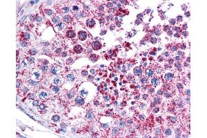 MAGEA3 antibody was used for immunohistochemistry at a concentration of 4-8 ug/ml.