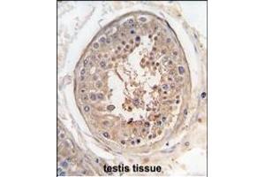 Formalin-fixed and raffin-embedded human testis tissue reacted with SG9 antibody (Center) (ABIN391447 and ABIN2841430) , which was peroxidase-conjugated to the secondary antibody, followed by DAB staining. (SPAG9 antibody  (AA 603-632))