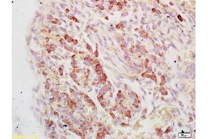Formalin-fixed and paraffin embedded mouse embryo labeled with Anti-EF1a Polyclonal Antibody, Unconjugated (ABIN741210) at 1:200, followed by conjugation to the secondary antibody and DAB staining (eEF1A1 antibody  (AA 131-230))
