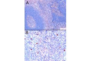 ABIN2562666 (1µg/ml) staining of paraffin embedded Human Tonsil. (FOXP3 antibody  (C-Term))