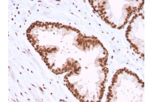 Immunohistochemistry (IHC) image for anti-Protein-tyrosine Phosphatase 1C (PTPN6) antibody (ABIN6939660)