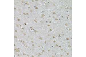 Immunohistochemistry of paraffin-embedded mouse brain using JMJD6 Antibody (ABIN5973452) at dilution of 1/100 (40x lens). (JMJD6 antibody)
