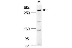 WB Image CAD antibody [C2C3], C-term detects CAD protein by Western blot analysis. (CAD antibody  (C-Term))