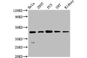 Western Blot Positive WB detected in: Hela whole cell lysate, 293T whole cell lysate, PC3 whole cell lysate, U87 whole cell lysate, Mouse kidney tissue All lanes: NDRG1 antibody at 0. (Recombinant NDRG1 antibody)