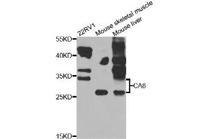 Western blot analysis of extracts of various cell lines, using CA8 antibody. (CA8 antibody)