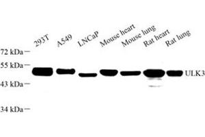 Western blot analysis of ULK3 (ABIN7076150) at dilution of 1: 1000 (ULK3 antibody)