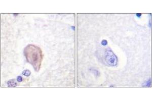 Immunohistochemistry analysis of paraffin-embedded human brain tissue, using C-RAF (Ab-43) Antibody. (RAF1 antibody  (AA 11-60))