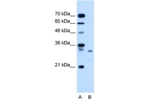 Western Blotting (WB) image for anti-Syndecan Binding Protein (Syntenin) (SDCBP) antibody (ABIN2463965) (SDCBP antibody)