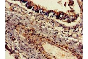 Immunohistochemistry of paraffin-embedded human lung tissue using ABIN7150873 at dilution of 1:100 (Dnah5 antibody  (AA 2364-2560))