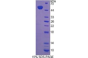 Image no. 1 for Coenzyme Q10 Homolog B (COQ10B) (AA 38-238) protein (His tag,GST tag) (ABIN4991095)
