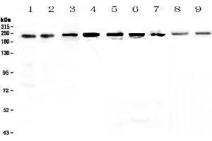 Western blot analysis of BRG1 using anti-BRG1 antibody . (SMARCA4 antibody  (AA 555-763))
