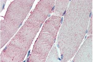 ABIN185115 (5µg/ml) staining of paraffin embedded Human Skeletal Muscle. (OSBPL1A antibody  (C-Term))