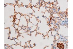ABIN6267576 at 1/200 staining Mouse lung tissue sections by IHC-P. (Smad2/3 antibody  (pThr8, Thr8))
