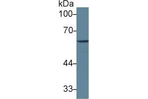 Detection of GAD1 in Mouse Cerebrum lysate using Polyclonal Antibody to Glutamate Decarboxylase 1, Brain (GAD1) (GAD antibody  (AA 1-97))