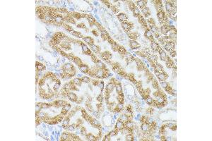 Immunohistochemistry of paraffin-embedded mouse kidney using  antibody (ABIN6131166, ABIN6136417, ABIN6136418 and ABIN6223845) at dilution of 1:100 (40x lens). (ACAT2 antibody  (AA 1-97))