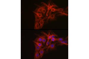 Immunofluorescence analysis of C6 cells using β-Tubulin Rabbit pAb (ABIN3020552, ABIN3020553 and ABIN3020554) at dilution of 1:100 (40x lens).