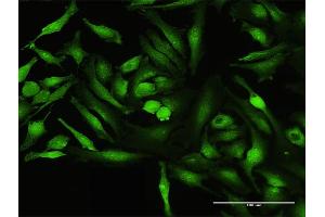 Immunofluorescence of purified MaxPab antibody to CALCOCO1 on HeLa cell. (CALCOCO1 antibody  (AA 1-691))