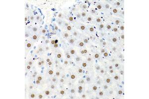 Immunohistochemistry of paraffin-embedded rat liver using PTBP1 antibody. (PTBP1 antibody  (AA 1-100))