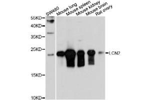 Western Blotting (WB) image for anti-Lipocalin 2 (LCN2) (AA 1-100) antibody (ABIN3017526)