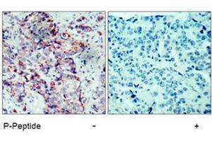 Image no. 1 for anti-Mitogen-Activated Protein Kinase Kinase 4 (MAP2K4) (pSer80) antibody (ABIN196910) (MAP2K4 antibody  (pSer80))