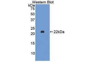 Detection of Recombinant SIRT3, Rat using Polyclonal Antibody to Sirtuin 3 (SIRT3) (SIRT3 antibody  (AA 127-303))