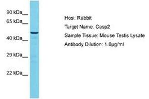 Image no. 1 for anti-Caspase 2, Apoptosis-Related Cysteine Peptidase (CASP2) (AA 301-350) antibody (ABIN6750405) (Caspase 2 antibody  (AA 301-350))