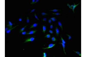 Immunofluorescent analysis of Hela cells using ABIN7143952 at dilution of 1:100 and Alexa Fluor 488-congugated AffiniPure Goat Anti-Rabbit IgG(H+L)