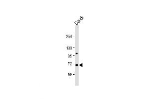 Western Blot at 1:1000 dilution + Daudi whole cell lysate Lysates/proteins at 20 ug per lane. (SIGLEC10 antibody  (C-Term))