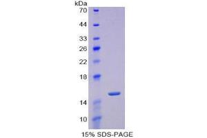 SDS-PAGE (SDS) image for Periostin (POSTN) (AA 370-494) protein (His tag) (ABIN1080496)